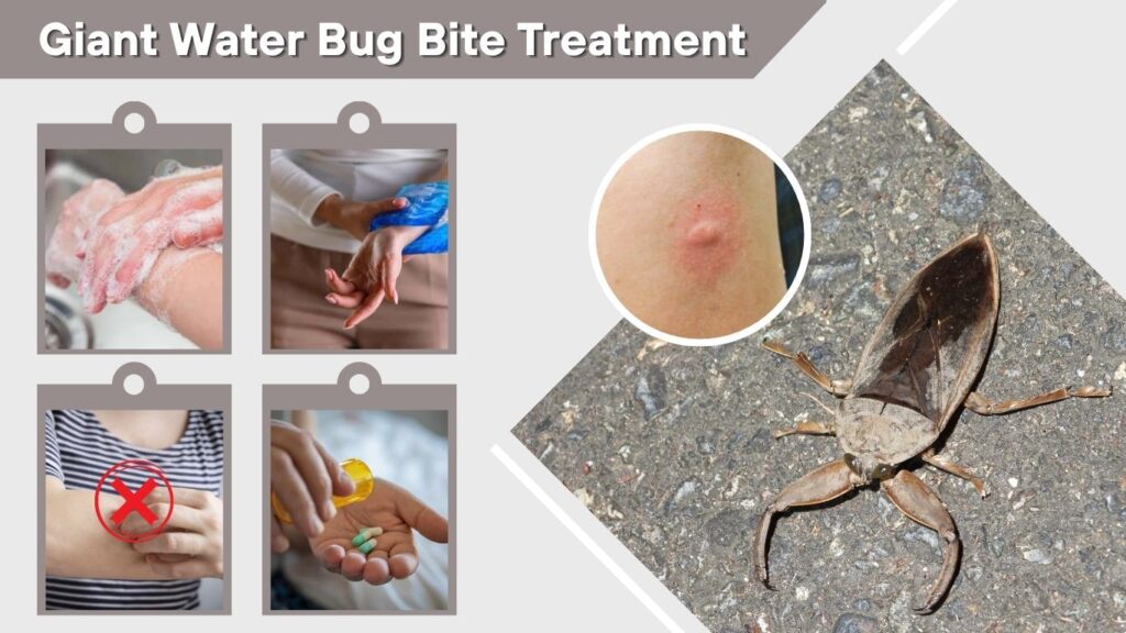 Giant Water Bug Bite Treatment