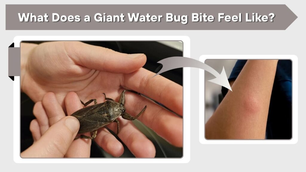 What Does a Giant Water Bug Bite Feel Like?