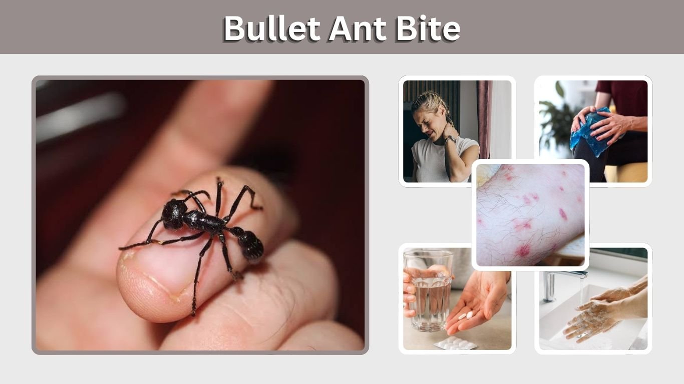Bullet Ant Bite: Pain, Bite Mark, Symptoms and Treatment