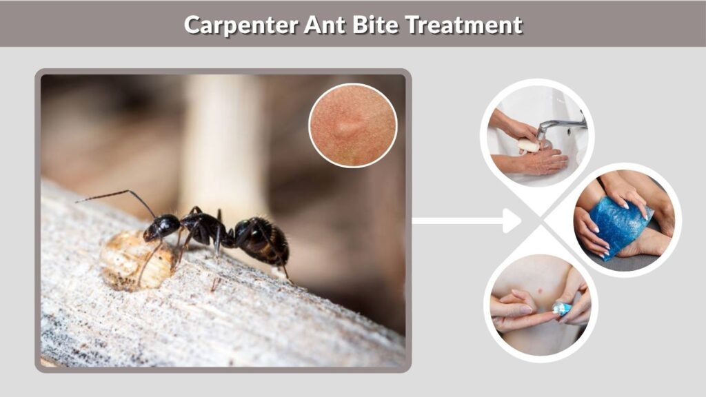 Carpenter Ant Bite Treatment