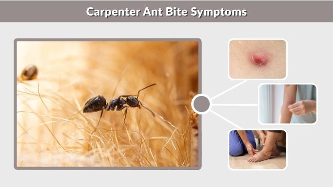 Carpenter Ant Bite Symptoms