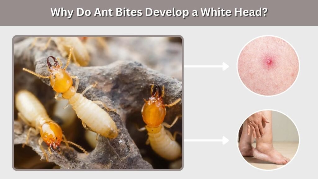 Why Do Ant Bites Develop a White Head?