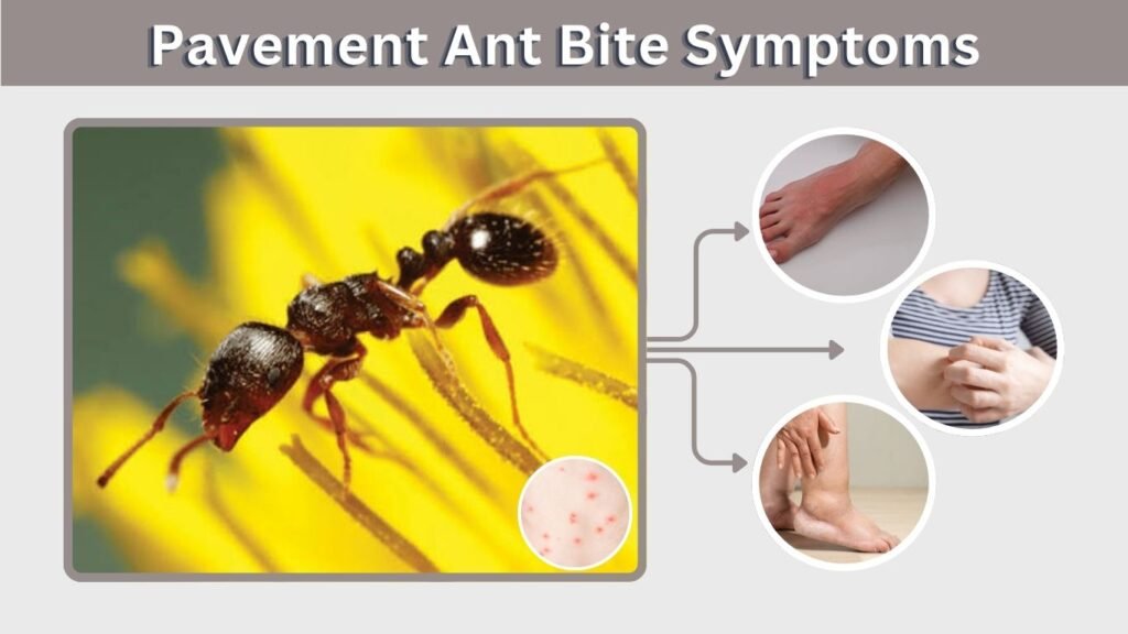 Pavement Ant Bite Symptoms
