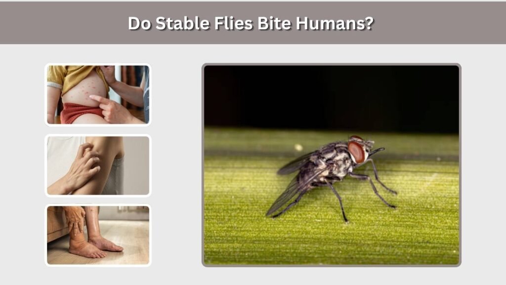 Do Stable Flies Bite Humans?