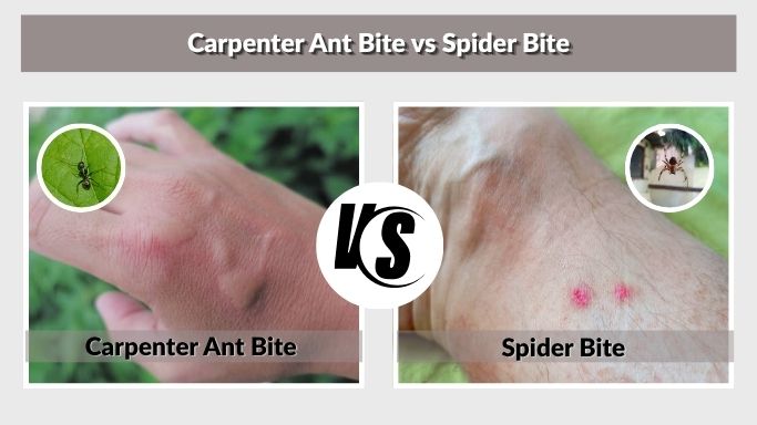 Carpenter Ant Bite vs Spider Bite