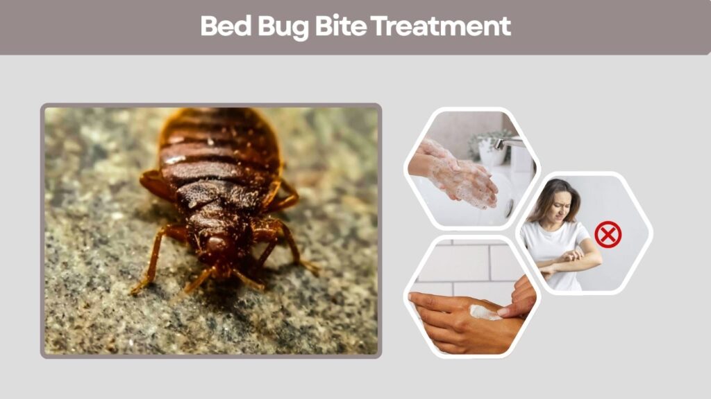 Bed Bug Bite Treatment