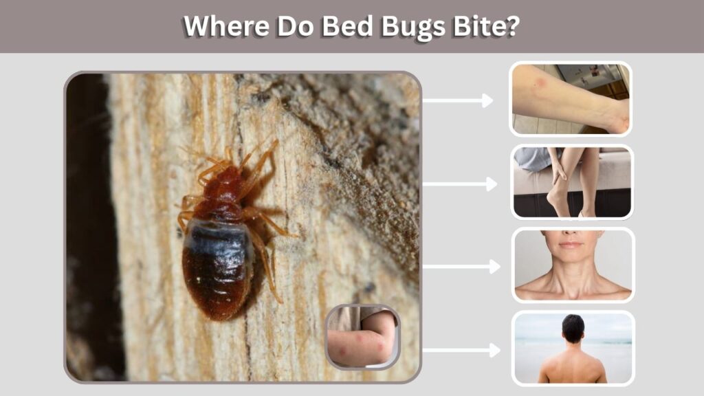 Where Do Bed Bugs Bite?