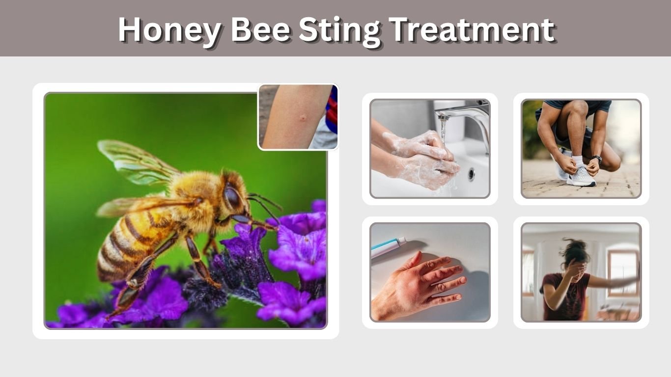 Honey Bee Sting Treatment: First Aid, Swelling Relief, and Home Care