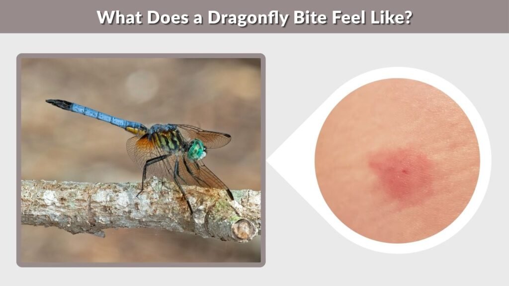 What Does a Dragonfly Bite Feel Like?