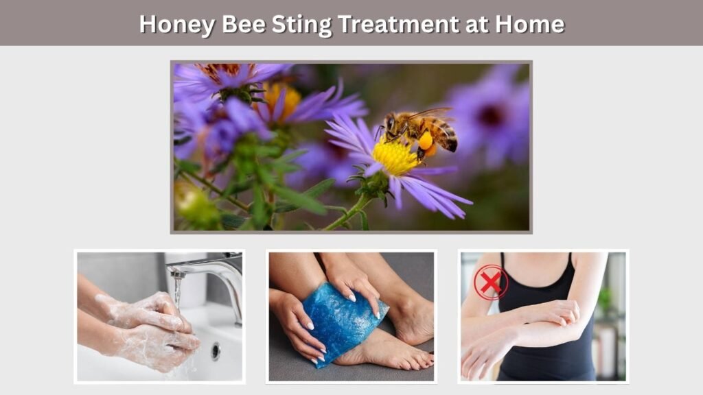 Honey Bee Sting Treatment at Home
