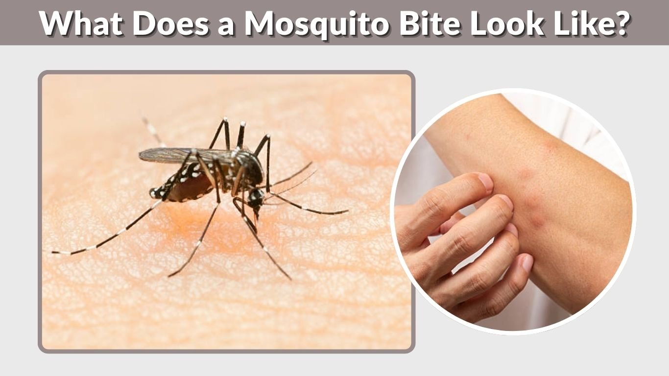 What Does a Mosquito Bite Look Like? Signs & Reactions