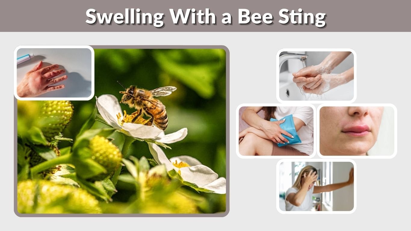 Swelling With a Bee Sting: What Helps and How Long It Lasts