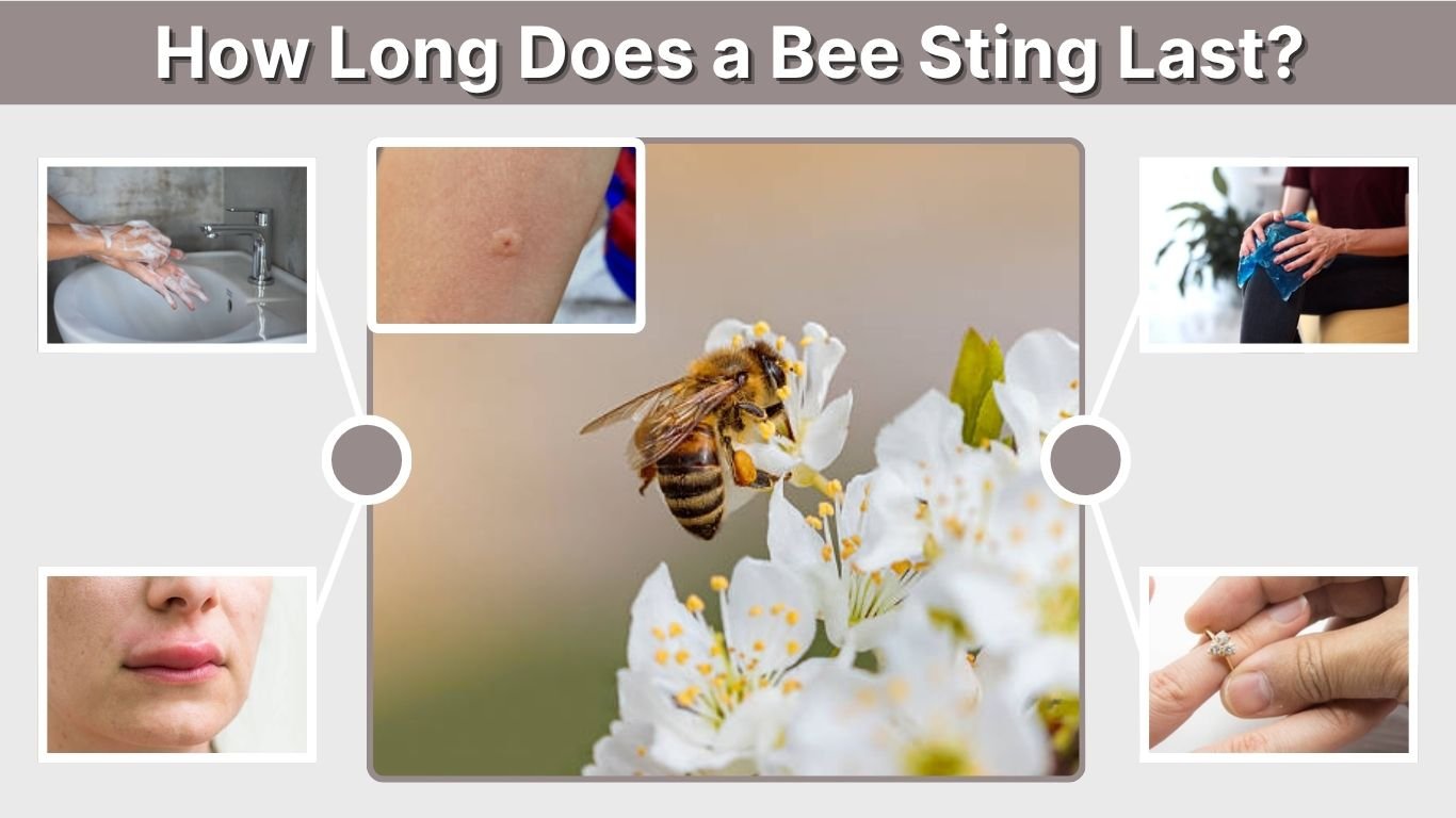 How Long Does a Bee Sting Last? Pain, Swelling & Itch