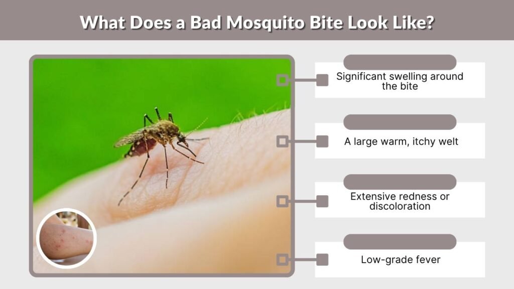 What Does a Bad Mosquito Bite Look Like?