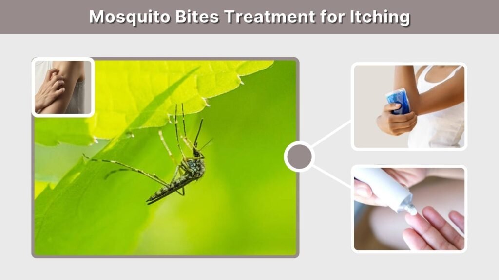 Mosquito Bites Treatment for Itching