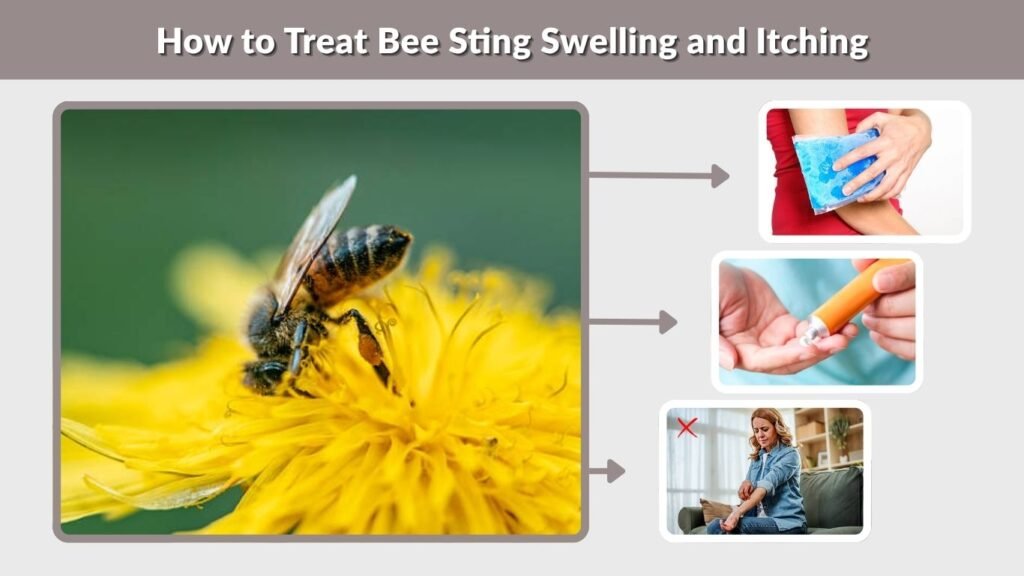 How to Treat Bee Sting Swelling and Itching