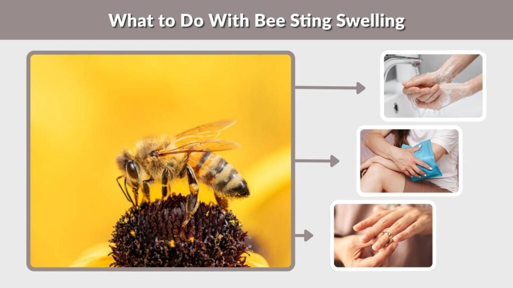What to Do With Bee Sting Swelling