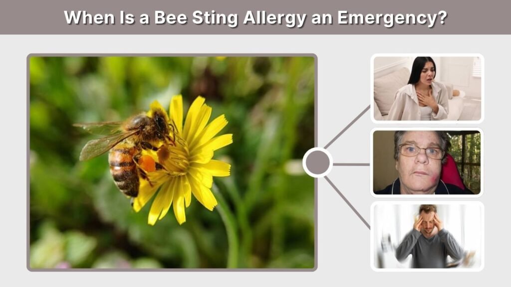 When Is a Bee Sting Allergy an Emergency?