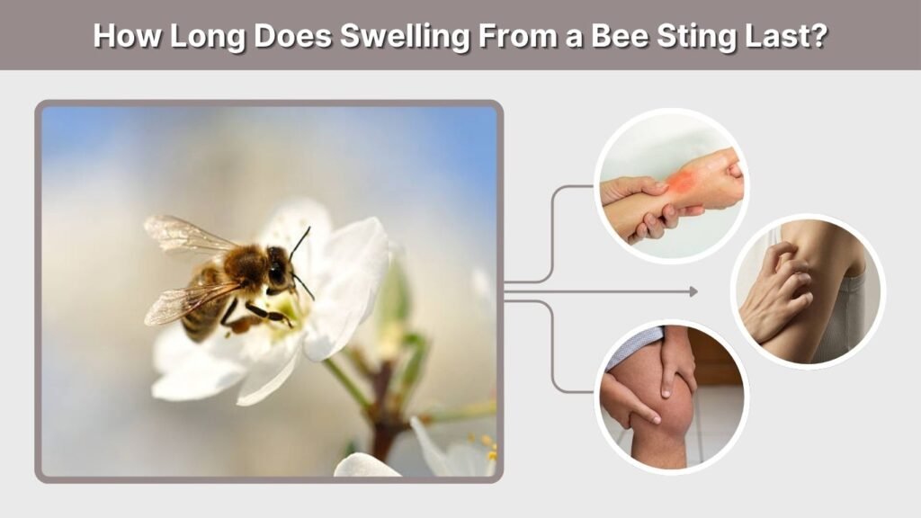 How Long Does Swelling From a Bee Sting Last?