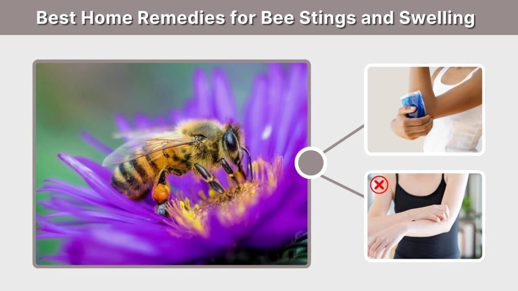 Best Home Remedies for Bee Stings and Swelling