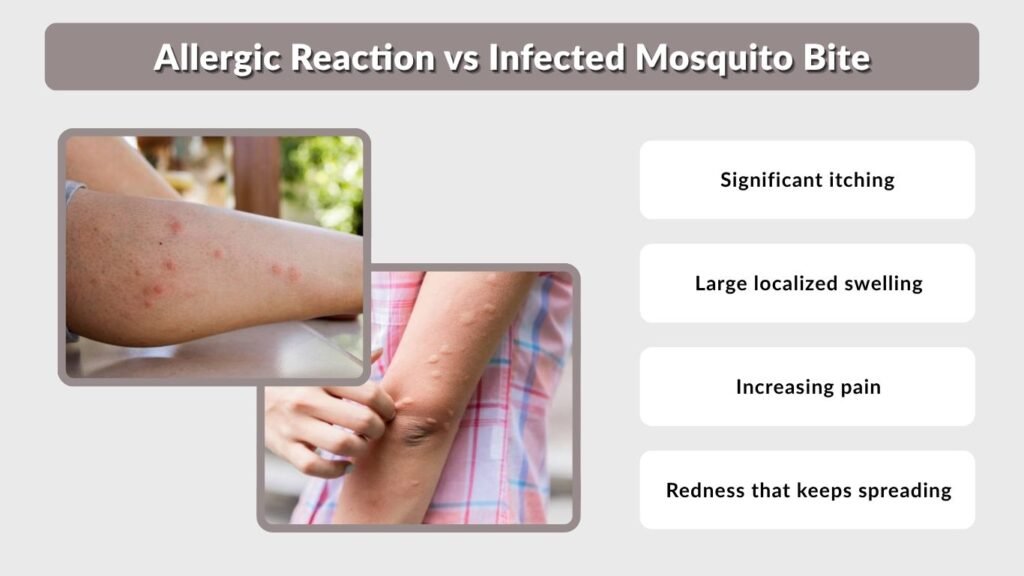 Allergic Reaction vs Infected Mosquito Bite