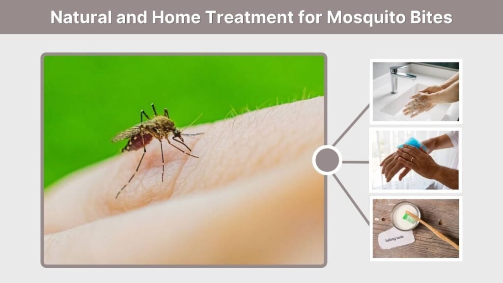 Natural and Home Treatment for Mosquito Bites