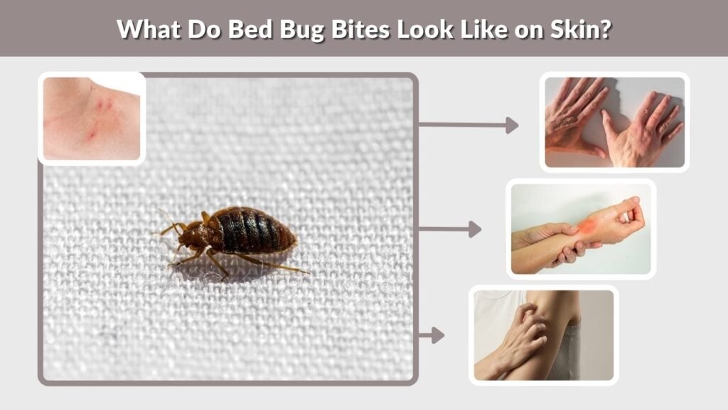 What Do Bed Bug Bites Look Like on Skin?