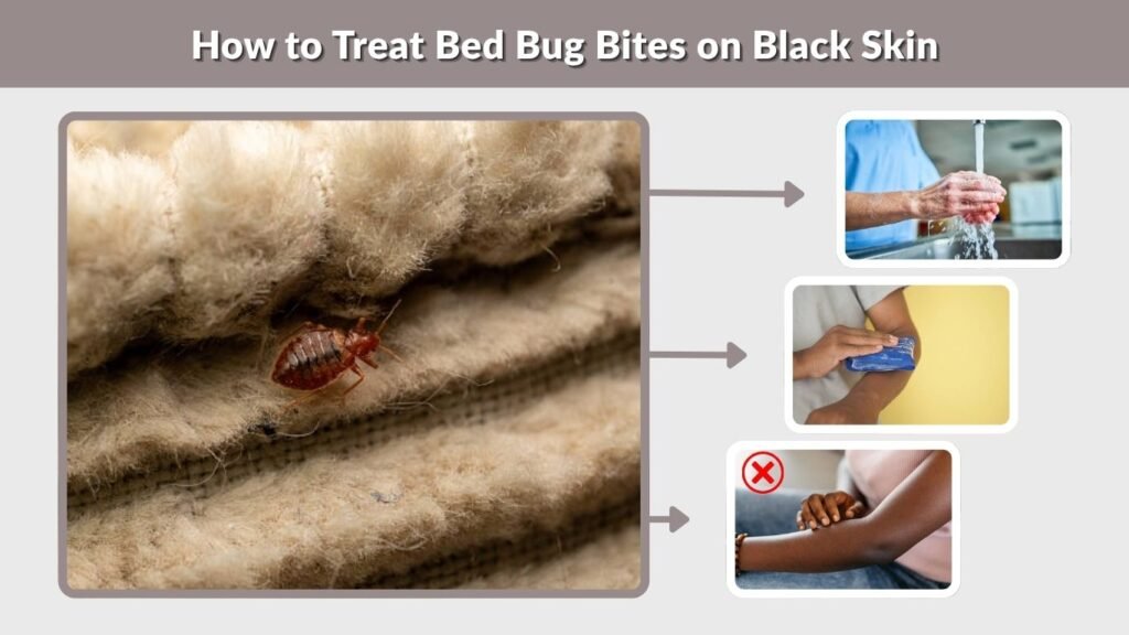 How to Treat Bed Bug Bites on Black Skin