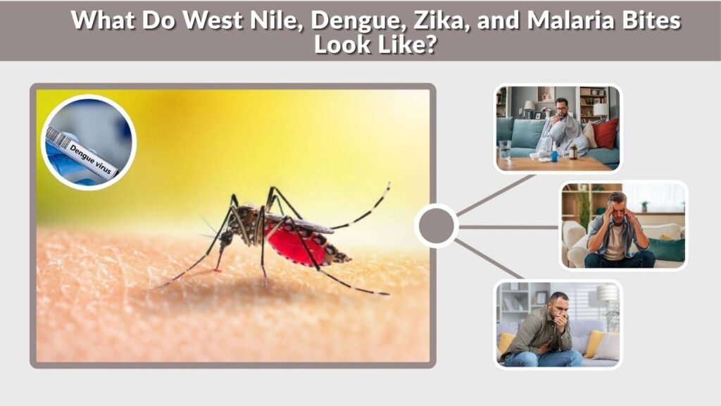 What Do West Nile, Dengue, Zika, and Malaria Bites Look Like?