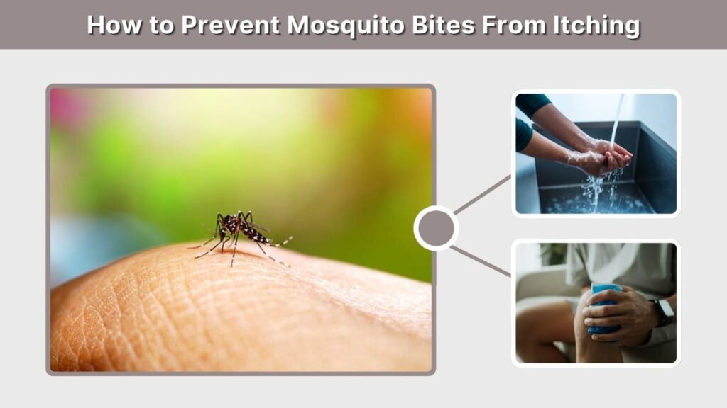How to Prevent Mosquito Bites From Itching