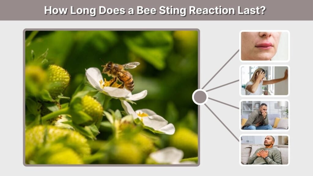 How Long Does a Bee Sting Reaction Last?