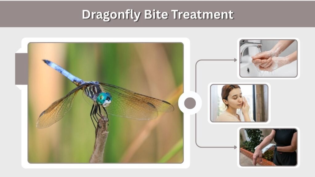 Dragonfly Bite Treatment
