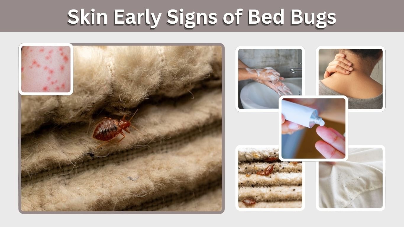 Skin Early Signs of Bed Bugs: Bites, Rash & Symptoms
