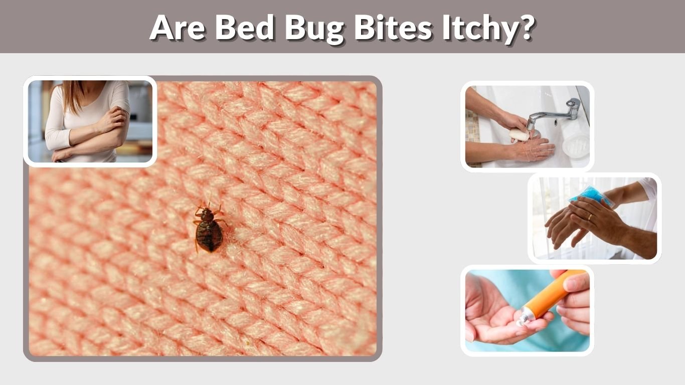 Are Bed Bug Bites Itchy? Causes, Duration, and Relief
