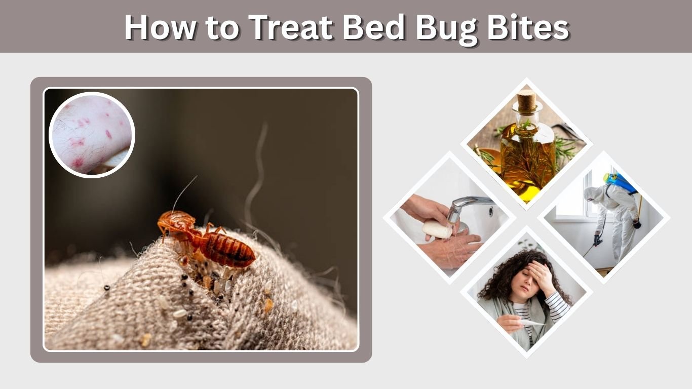 How to Treat Bed Bug Bites: Home Remedies & Fast Relief