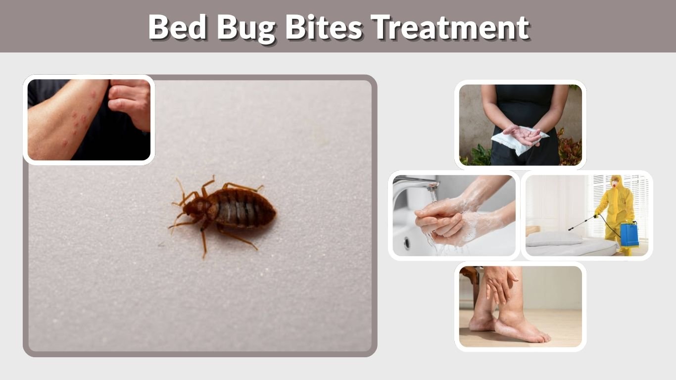 Bed Bug Bites Treatment: Relief, Remedies & Skin Care