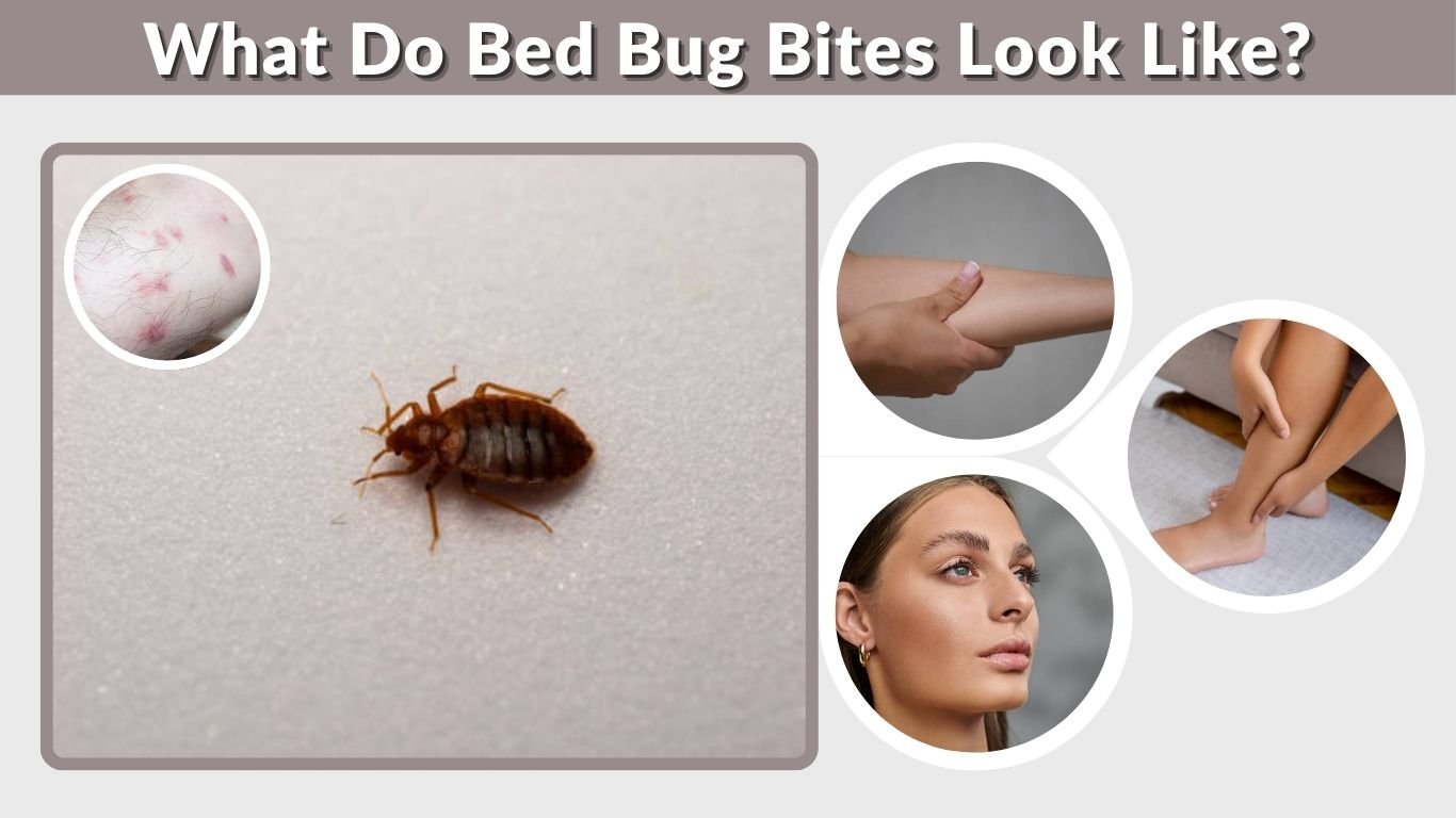 What Do Bed Bug Bites Look Like? Signs, Stages & Tips