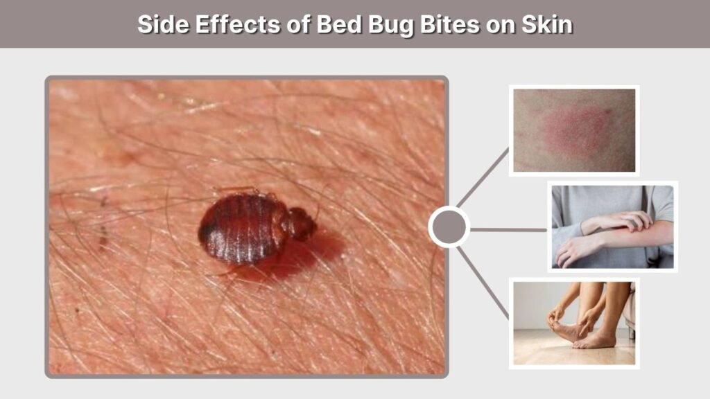 Side Effects of Bed Bug Bites on Skin