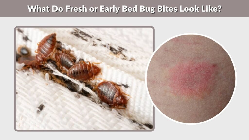 What Do Fresh or Early Bed Bug Bites Look Like?