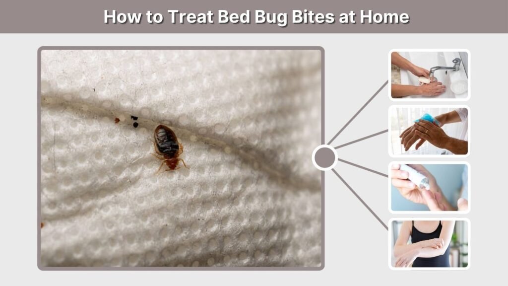 How to Treat Bed Bug Bites at Home