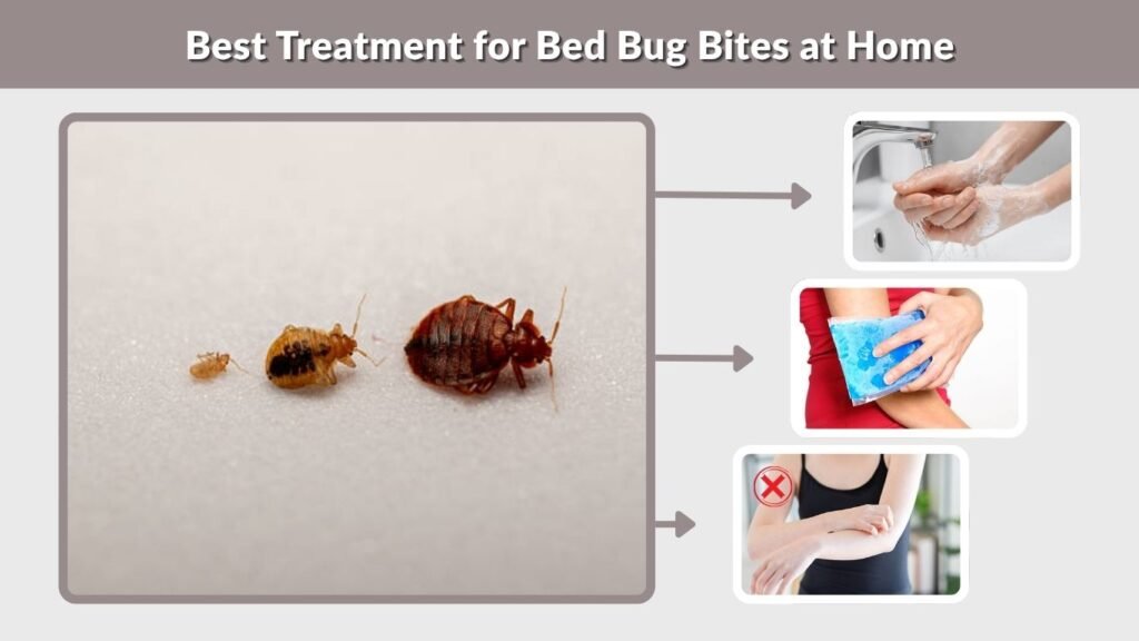 Best Treatment for Bed Bug Bites at Home