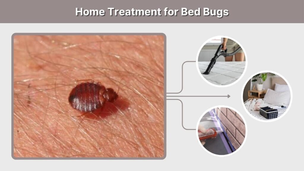 Home Treatment for Bed Bugs
