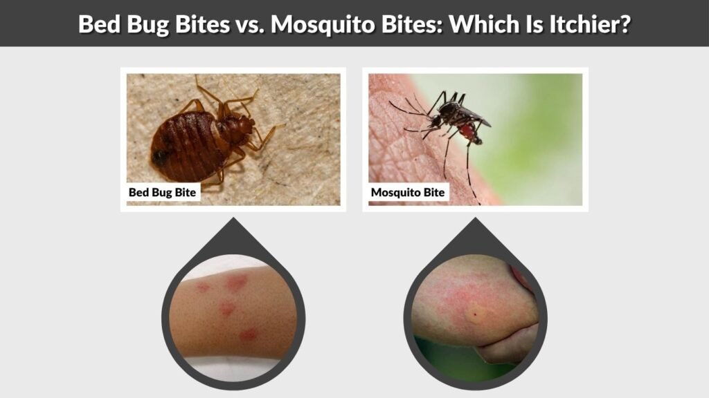 Bed Bug Bites vs. Mosquito Bites: Which Is Itchier?