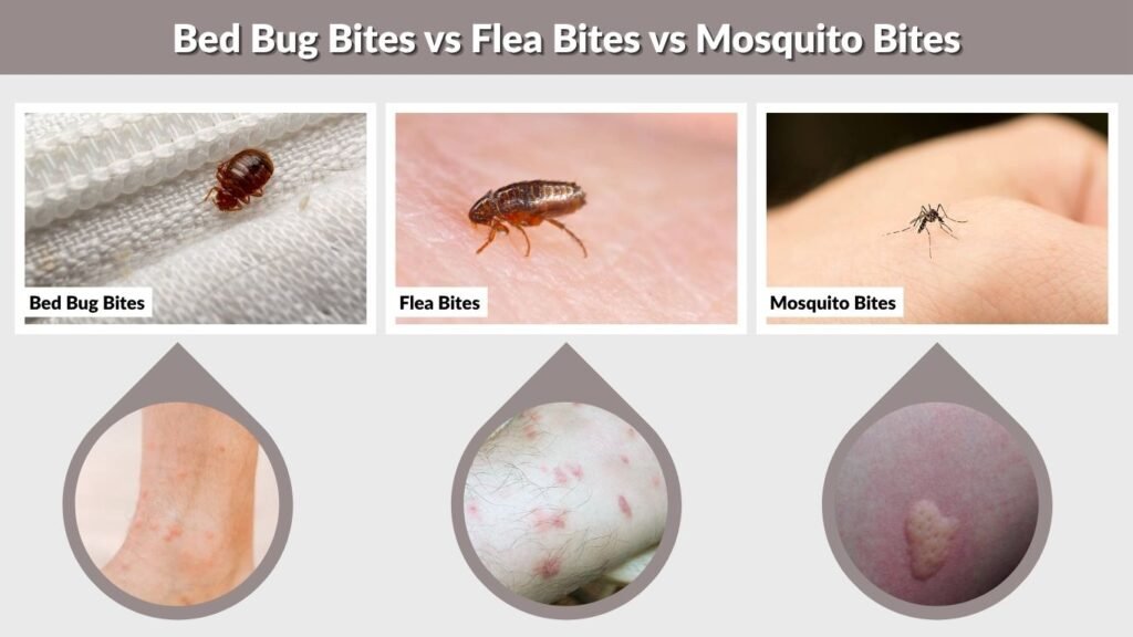 Bed Bug Bites vs Flea Bites vs Mosquito Bites