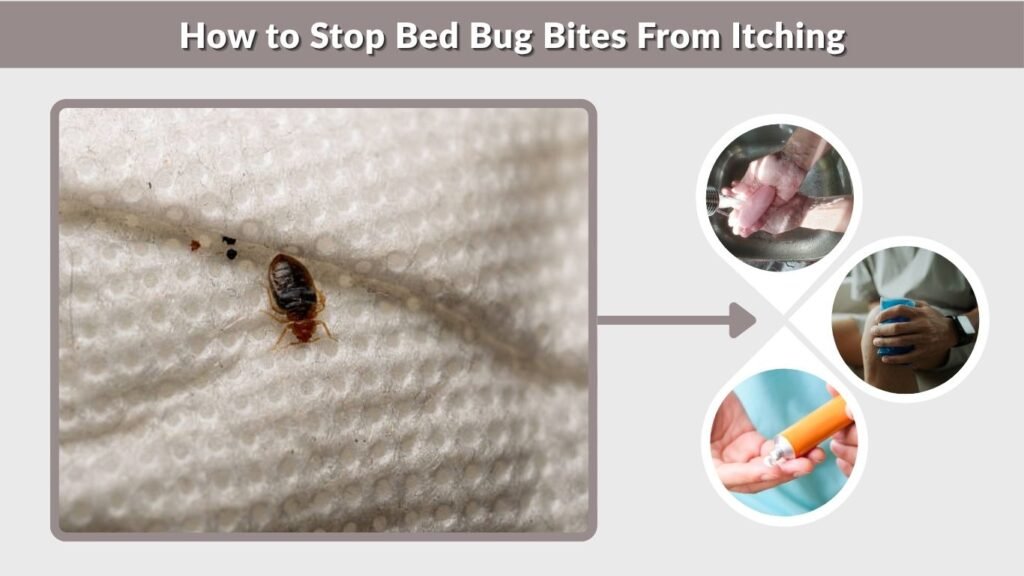 How to Stop Bed Bug Bites From Itching