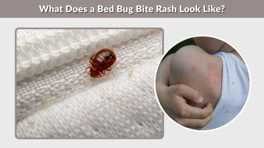 What Does a Bed Bug Bite Rash Look Like?