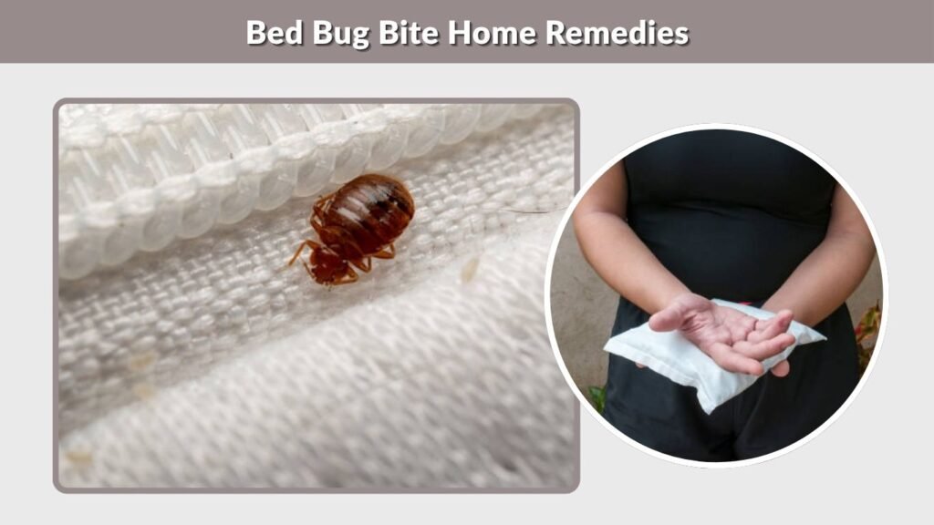 Bed Bug Bite Home Remedies