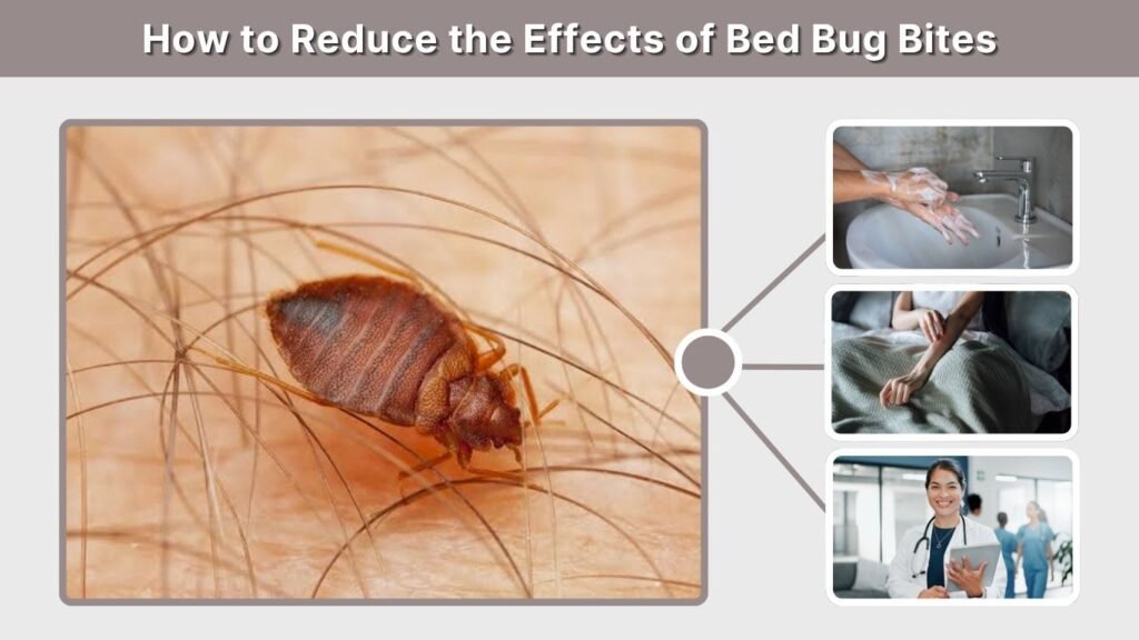 How to Reduce the Effects of Bed Bug Bites