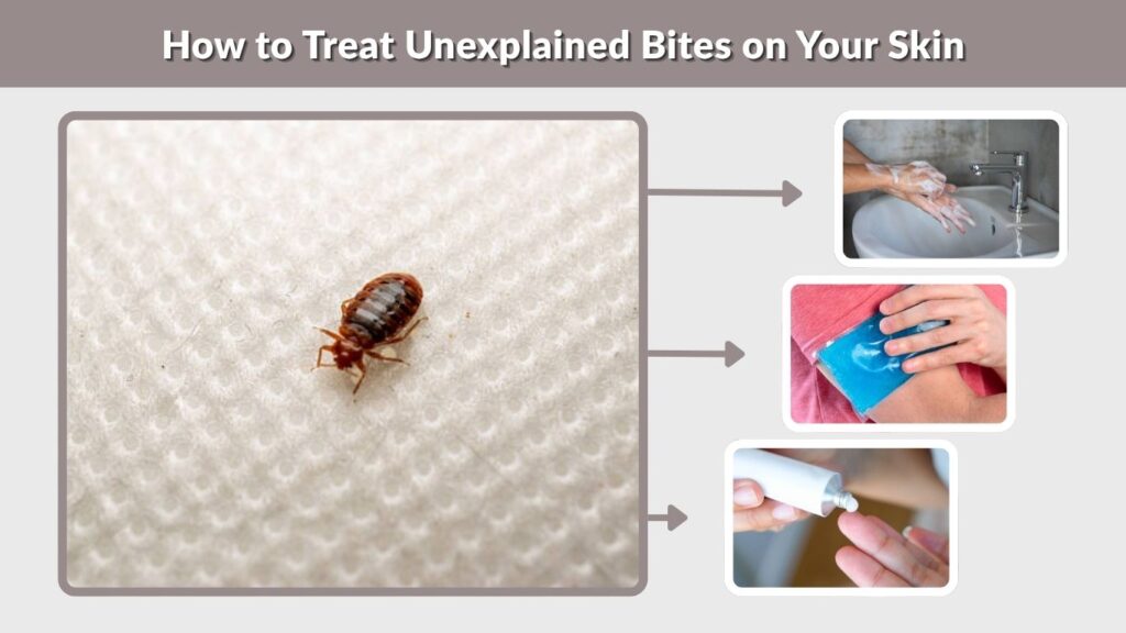 How to Treat Unexplained Bites on Your Skin