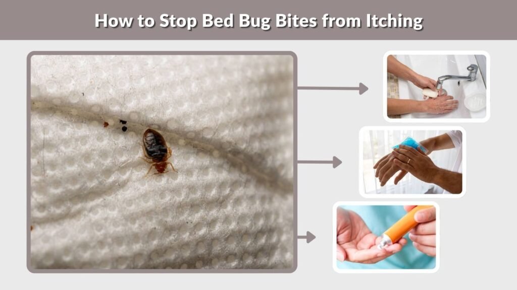 How to Stop Bed Bug Bites from Itching